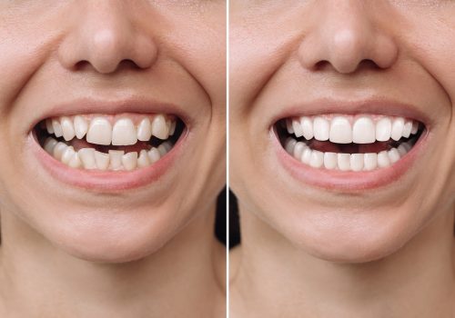 Cropped shot of a young caucasian smiling woman before and after