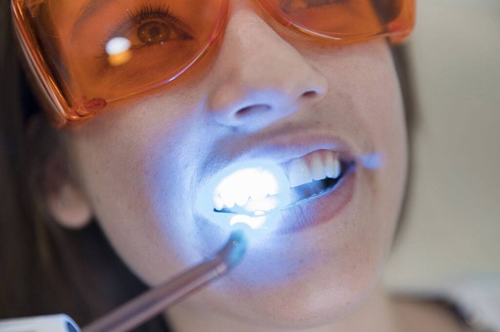 blanqueamiento-1024x679