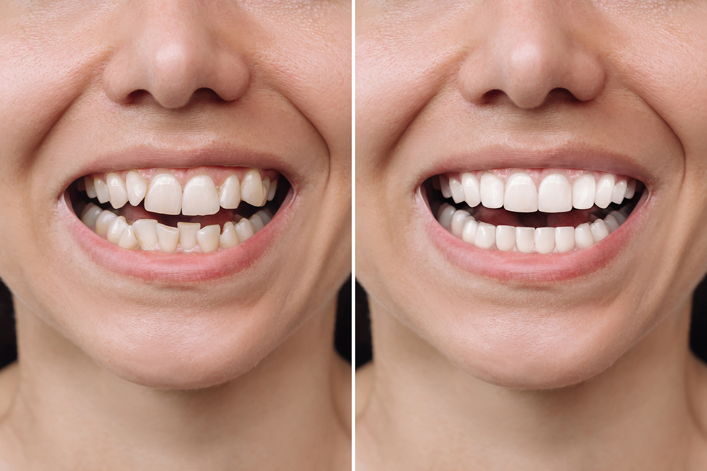 Cropped shot of a young caucasian smiling woman before and after