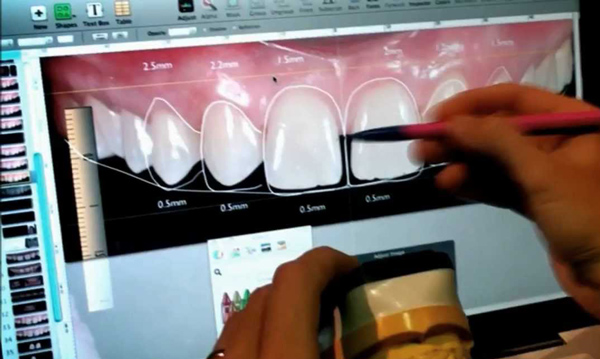 diseno-digital-sonrisa1